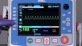 X Series® Advanced Cardioversion English [upl. by Mika]