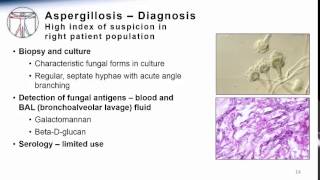 Aspergillosis [upl. by Bank]