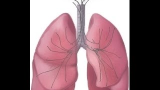 BREATH SOUNDS Stages of Fluid Overload Pneumonia [upl. by Alliuqa963]