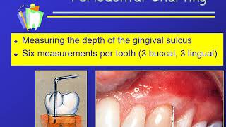 Charting Sequence and Periodontal Charting [upl. by Collin]