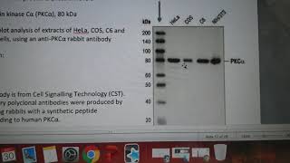 Western blotting data analysis example and work through LS5001 [upl. by Ecarret]