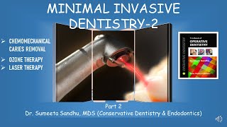 Minimal invasive dentistry Chemomechanical caries removal Laser therapy Ozone therapy [upl. by Mcloughlin]