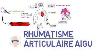 Rhumatisme articulaire aigu RAAde A à Z [upl. by Drofkcor]