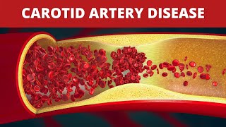 External Carotid Artery  Anatomy Branches amp Relations [upl. by Manville271]