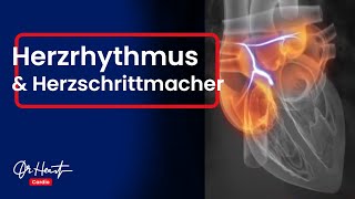 Herzrhythmusstörungen und Herzschrittmacher  Wer braucht ihn  Dr Heart [upl. by Stubbs]