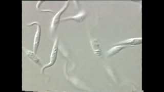 Trypanosoma [upl. by Kalfas]