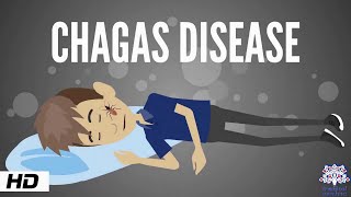 Chagas Disease Causes Signs and Symptoms Diagnosis and Treatment [upl. by Florencia573]