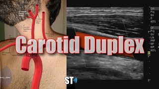 Carotid Artery Ultrasound [upl. by Ahseihs]