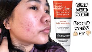 Neutrogena Rapid Clear Stubborn Acne Spot Gel Does it work [upl. by Amocat]