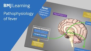 Pathophysiology of fever explained [upl. by Ifen]