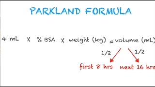 Parkland Formula Made Easy [upl. by Robaina]