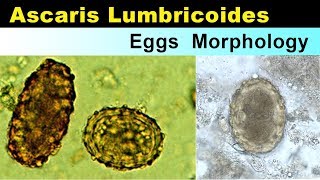 Ascaris lumbricoides eggs Morphology [upl. by Tizes130]