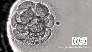 Human Embryo Growing from Fertilization to Day 6 Blastocyst [upl. by Svirad]