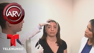 Alertan contra inyecciones para rejuvenecer el rostro  Al Rojo Vivo  Telemundo [upl. by Alfi635]