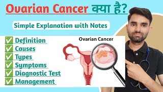 Ovarian Cancer in Hindi  Types Causes Symptoms And Treatment of Ovarian Cancer [upl. by Animehliw]