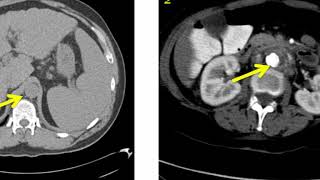 Introduction to Radiology Computed Tomography [upl. by Ainel]