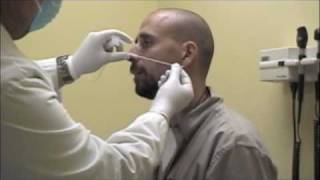 Procedure for Nasopharyngeal Swabs and Aspirates [upl. by Casia717]