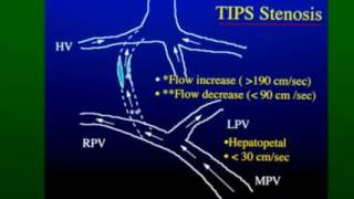 Video 5  Decontamination [upl. by Airamana588]