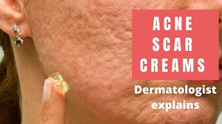 Acne Scar Creams  Dermatologist Reviews [upl. by Aidnic]