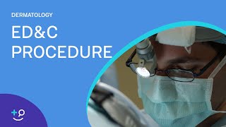 EDampC Procedure Overview Dermatology [upl. by Imotas]