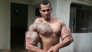 Bodybuilder nearly dies after bicep injections [upl. by Teddie]