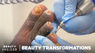 How Medical Pedicures Transform Feet [upl. by Nnahaid265]