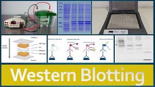 Western Blotting  Principle Procedure and Applications [upl. by Gnouv]