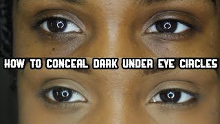 HOW TO Conceal DARK UNDER EYE CIRCLES  Makeup For Black Women [upl. by Bernita]