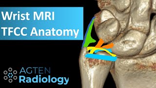 MRI Anatomy of TFCC [upl. by Aztinay150]