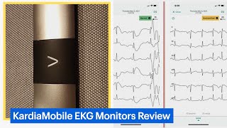 KardiaMobile Personal EKG Monitors Review [upl. by Imak]