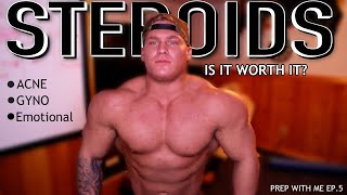 How Steroids Ruined My Life [upl. by Aeresed]