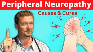 Peripheral NEUROPATHY Causes and Cures 2024 [upl. by Haidebez]