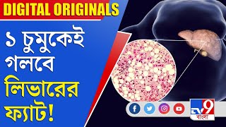 Fatty Liver ১ চুমুকেই গলবে লিভারের ফ্যাট [upl. by Antonie273]