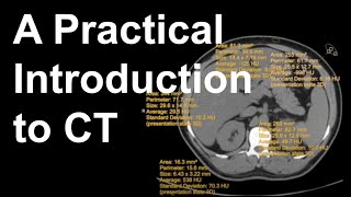 How Functional Ultrasound Works [upl. by Lynd102]