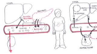 Diabetes Type II Pathophysiology [upl. by Harry]