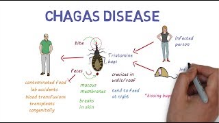 Chagas Disease  An overview [upl. by Deyes]