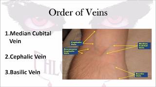 VARICOSE VEINS How To DIAGNOSE amp TREAT Venous Diseases [upl. by Arob424]