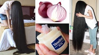 How to use Vaseline and onions to grow hair 2 centimeters a day [upl. by Revilo]