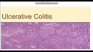 Medications for IBD Crohns and Colitis Featuring Dr Alan Low  GI Society [upl. by Adnorrahs]