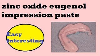 Zinc oxide Eugenol impression paste [upl. by Idnem]