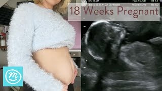 18 Weeks Pregnant What You Need To Know  Channel Mum [upl. by Haidedej]