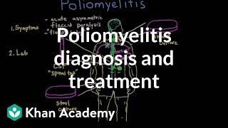 Microbiology 494 c PolioMyelitis Clinical Features Polio [upl. by Teodor893]