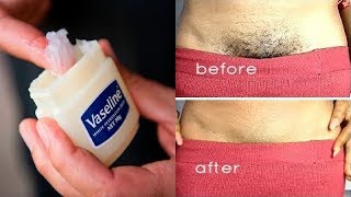 Remove Unwanted Hair In 2 Minutes With Vaseline [upl. by Iveksarap]