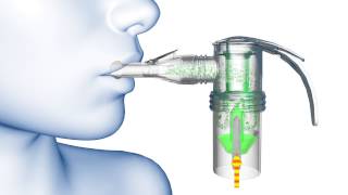 PARI LC® Nebulizer Animation [upl. by Adnahs]