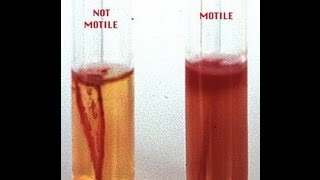 Motility Determination in Bacteria  Amrita University [upl. by Gilberta]