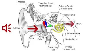 Middle and inner ear tumors [upl. by Mischa]