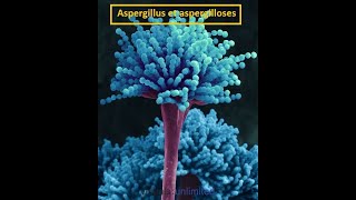 Parasitologie Lexplication la plus facile de laspargillose [upl. by Jacobsohn]