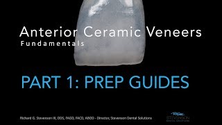 Anterior Ceramic Veneers Part 1 Preparation Guides [upl. by Jessee267]