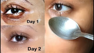 How to Remove Under Eye WRINKLES Under Eye Bags Puffy eyes amp Dark Circles in 1 Day with ice cubes [upl. by Durham155]