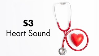 S3 Heart Sound  MEDZCOOL [upl. by Chaudoin20]